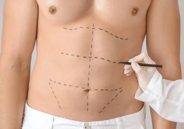 وقتی بیماران به مدل پیکرتراشی تبدیل می شوند، اقتصاد پنهان عکس های قبل و بعد پیکرتراشی