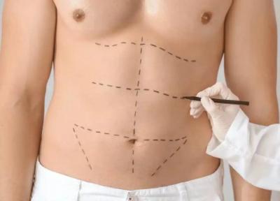 وقتی بیماران به مدل پیکرتراشی تبدیل می شوند، اقتصاد پنهان عکس های قبل و بعد پیکرتراشی